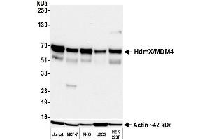 Western Blotting (WB) image for anti-Mdm4-binding Protein (MDM4) (AA 125-175) antibody (ABIN7795618)