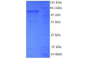 Non-Muscle Myosin Heavy Polypeptide 9 (MYH9) (AA 2-241), (partial) protein (GST tag) (Myosin 9 Protein (MYH9) (AA 2-241, partial) (GST tag))