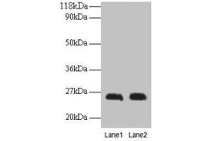Western blot All lanes: CSH1 antibody at 2 μg/mL Lane 1: A549 whole cell lysate Lane 2: U251 whole cell lysate Secondary Goat polyclonal to rabbit IgG at 1/15000 dilution Predicted band size: 26 kDa Observed band size: 26 kDa (CSH1 antibody  (AA 27-217))