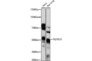 Western Blotting (WB) image for anti-Transforming Growth Factor beta 1 Induced Transcript 1 (TGFB1I1) (AA 1-150) antibody (ABIN6149074)