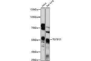 Western blot analysis of extracts of various cell lines, using TGFB1I1 antibody (ABIN6129144, ABIN6149074, ABIN6149075 and ABIN6224526) at 1:1000 dilution. (TGFB1I1 antibody  (AA 1-150))