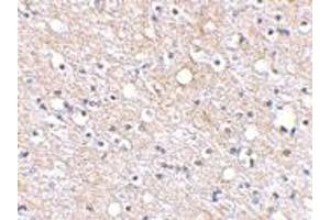 Immunohistochemical staining of human brain tissue using PLXDC2 polyclonal antibody  at 2. (PLXDC2 antibody  (N-Term))