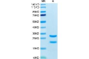 SDS-PAGE (SDS) image for Mannan-Binding Lectin serine Peptidase 2 (MASP2) (AA 287-685) protein (His tag,Biotin) (ABIN7275295)