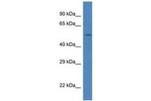 Image no. 1 for anti-Sushi-Repeat Containing Protein, X-Linked (SRPX) (C-Term) antibody (ABIN6747250) (SRPX antibody  (C-Term))