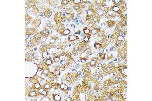 Immunohistochemistry of paraffin-embedded human liver using Cytochrome P450 4A (CYP4) (CYP4) Rabbit mAb (ABIN7266658) at dilution of 1:100 (40x lens). (CYP4A11 antibody)