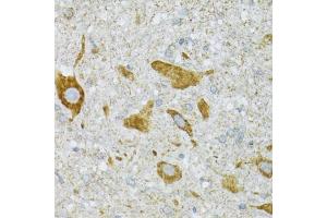 Immunohistochemistry of paraffin-embedded mouse spinal cord using ST3GAL3 antibody (ABIN2560155) at dilution of 1:100 (40x lens). (ST3GAL3 antibody)