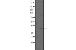 Western blot analysis of MAGEB5 expression in Human fetal liver lysate ;;,The lane on the left is treated with the antigen-specific peptide. (MAGEB5 antibody  (N-Term))