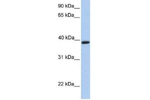 Aquaporin 10 antibody used at 1 ug/ml to detect target protein. (Aquaporin 10 antibody  (C-Term))