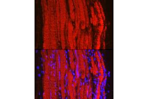 Immunofluorescence analysis of mouse skeletal muscle using Fbx32/FBOX32 Rabbit pAb (ABIN6134167, ABIN6140522 and ABIN7101804) at dilution of 1:100 (40x lens).