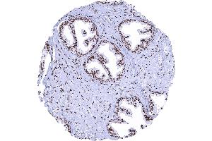 Prostate A strong nuclear AR immunostaining is seen in stromal and epithelial cells of the prostate. (Recombinant Androgen Receptor antibody  (AA 1-100))