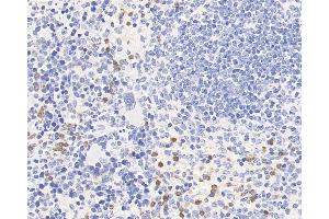 Immunohistochemistry analysis of paraffin-embedded mouse spleen using CCR5 Polyclonal Antibody at dilution of 1:300.