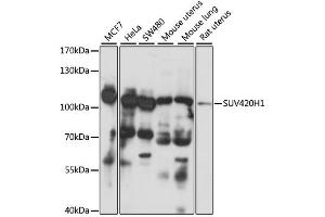 Western blot analysis of extracts of various cell lines, using SUV420H1 antibody.