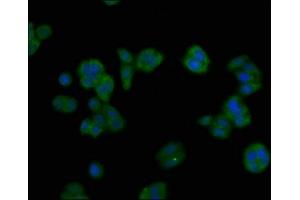 Immunofluorescent analysis of HepG2 cells using ABIN7144709 at dilution of 1:100 and Alexa Fluor 488-congugated AffiniPure Goat Anti-Rabbit IgG(H+L) (Asialoglycoprotein Receptor 1 antibody  (AA 68-291))