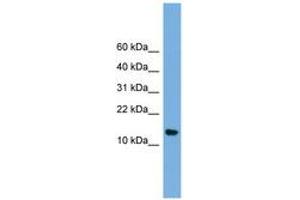 NAA38 antibody  (N-Term)