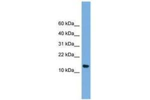 Image no. 1 for anti-N(alpha)-Acetyltransferase 38, NatC Auxiliary Subunit (NAA38) (N-Term) antibody (ABIN6744697)