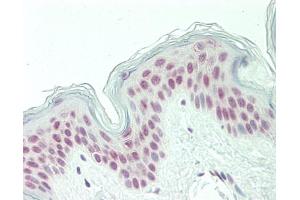 Human Skin: Formalin-Fixed, Paraffin-Embedded (FFPE). (PQBP1 antibody  (AA 72-121))