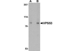 Western blot analysis of VPS53 in 293 cell lysate with VPS53 antibody at (A) 0. (VPS53 antibody  (C-Term))