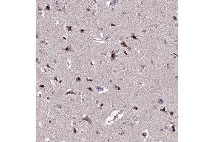Immunohistochemical staining of human cerebral cortex with INPP4A polyclonal antibody ( Cat # PAB28004 ) shows strong cytoplasmic positivity in neuronal cells.