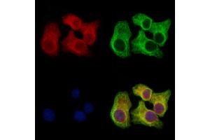 Clathrin heavy chain Antibody staining Hela cells by IF/ICC.