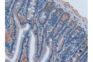 DAB staining on IHC-P; Samples: Rat Intestine Tissue (TNFSF14 antibody  (AA 58-239))