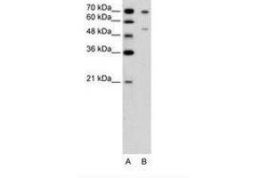 Image no. 1 for anti-Forkhead Box B2 (FOXB2) (AA 51-100) antibody (ABIN6736646) (FOXB2 antibody  (AA 51-100))