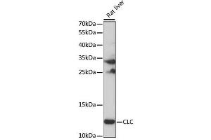 Western blot analysis of extracts of Rat liver, using CLC antibody (ABIN6292448) at 1:1000 dilution. (Galectin 10 antibody)