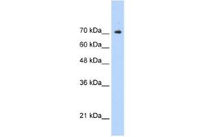 WB Suggested Anti-STAT1 Antibody Titration:  0. (STAT1 antibody  (C-Term))