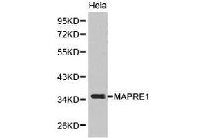Western Blotting (WB) image for anti-Ankyrin Repeat and Sterile alpha Motif Domain Containing 1B (ANKS1B) antibody (ABIN1873638)