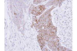 IHC-P Image Immunohistochemical analysis of paraffin-embedded DLD1 xenograft, using RAB3C, antibody at 1:500 dilution. (Rab3c antibody)