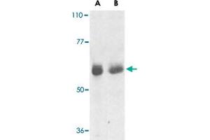 Western blot analysis of TRAF3IP2 expression in human lung (lane A) and placenta (lane B) tissue lysates with TRAF3IP2 polyclonal antibody  at 1 ug /mL .