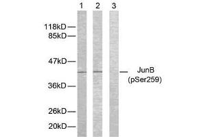 Western blot analysis of extracts from HeLa cells using JunB (phospho-Ser259) antibody (E011027). (JunB antibody  (pSer259))