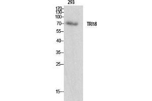 Western Blot (WB) analysis of specific cells using Midline-1 Polyclonal Antibody. (MID1 antibody  (N-Term))