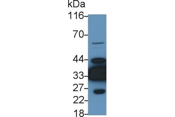 LDHB antibody  (AA 1-334)