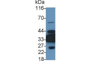 Detection of LDHB in Rat Heart lysate using Polyclonal Antibody to Lactate Dehydrogenase B (LDHB) (LDHB antibody  (AA 1-334))