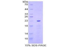 SDS-PAGE (SDS) image for Paraoxonase 1 (PON1) (AA 2-186) protein (His tag) (ABIN2121820) (PON1 Protein (AA 2-186) (His tag))