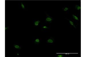 Immunofluorescence of monoclonal antibody to POLR2F on HeLa cell. (POLR2F antibody  (AA 1-127))