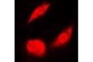 Immunofluorescent analysis of OSGEP staining in A549 cells. (OSGEP antibody)