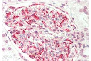 Rabbit Anti-EIF6 antibody Catalog Number: ARP61387 Formalin Fixed Paraffin Embedded Tissue: Human Kidney Primary antibody Concentration: 1:100 Secondary Antibody: Donkey anti-Rabbit-Cy3 Secondary Antibody Concentration: 1:200 Magnification: 20x Exposure Time: 0. (EIF6 antibody  (C-Term))