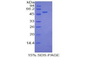 SDS-PAGE (SDS) image for Angiopoietin-Like 3 (ANGPTL3) (AA 10-196) protein (His tag) (ABIN2120580) (ANGPTL3 Protein (AA 10-196) (His tag))