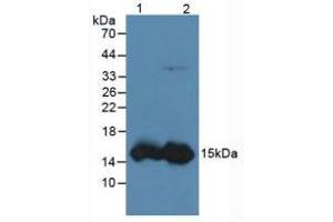 Figure. (FABP1 antibody  (AA 2-127))