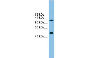 WB Suggested Anti-GART Antibody Titration: 0. (GART antibody  (Middle Region))