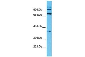 Host: Rabbit Target Name: TMPRSS7 Sample Type: Jurkat Whole Cell lysates Antibody Dilution: 1. (TMPRSS7 antibody  (N-Term))