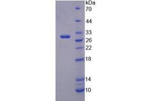 SDS-PAGE analysis of Mouse TRIM5 Protein. (TRIM5 Protein)