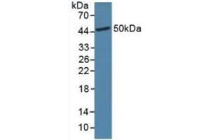 Detection of GLP1R in Mouse Brain Tissue using Polyclonal Antibody to Glucagon Like Peptide 1 Receptor (GLP1R) (GLP1R antibody  (AA 25-145))