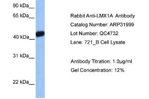 Western Blotting (WB) image for anti-LIM Homeobox Transcription Factor 1, alpha (LMX1A) (Middle Region) antibody (ABIN182469) (LMX1A antibody  (Middle Region))