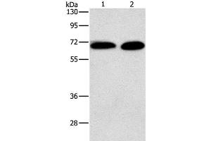 Western Blot analysis of Jurkat and NIH/3T3 cell using PRKCA Polyclonal Antibody at dilution of 1:500 (PKC alpha antibody)