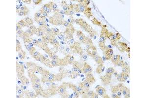 Immunohistochemistry of paraffin-embedded Human liver damage using CETN3 Polyclonal Antibody at dilution of 1:100 (40x lens). (CETN3 antibody)