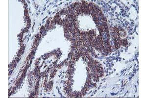 Immunohistochemical staining of paraffin-embedded Human breast tissue using anti-ALOX15 mouse monoclonal antibody. (ALOX15 antibody)