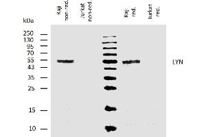 Western blotting analysis of human LYN using mouse monoclonal antibody LYN-01 on lysates of Raji cell line and Jurkat cell line (LYN non-expressing cell line, negative control) under non-reducing and reducing conditions. (LYN antibody  (AA 8-238))