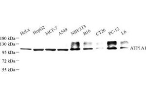 Western blot analysis of ATP1A1 (ABIN7073153) at dilution of 1: 500 (ATPase (Na/K) antibody)